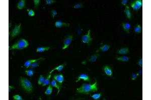Immunofluorescent analysis of U251 cells using ABIN7173253 at dilution of 1:100 and Alexa Fluor 488-congugated AffiniPure Goat Anti-Rabbit IgG(H+L) (TMEM61 antibody  (AA 90-210))