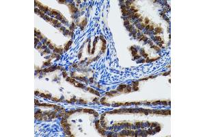 Immunohistochemistry of paraffin-embedded rat fallopian tube using HSPH1 antibody (ABIN2563287) at dilution of 1:100 (40x lens).