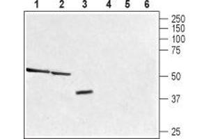 Western blot analysis of rat liver (lane 1 and 4), mouse kidney (lanes 2 and 5) and human brain glioblastoma (U-87) cell (lanes 3 and 6) lysates: - 1-3. (TAAR1 antibody  (C-Term, Intracellular))