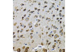 Immunohistochemistry of paraffin-embedded rat brain using NCF4 Antibody (ABIN5971122) at dilution of 1/100 (40x lens). (NCF4 antibody)