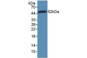 Detection of Recombinant VIM, Human using Monoclonal Antibody to Vimentin (VIM) (Vimentin antibody)