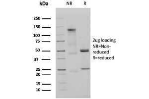 SDS-PAGE Analysis Purified IgM Recombinant Rabbit Monoclonal Antibody (IGHM/3135R). (Recombinant IGHM antibody)