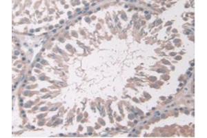 IHC-P analysis of Rat Testis Tissue, with DAB staining. (Adiponectin Receptor 2 antibody  (AA 1-147))