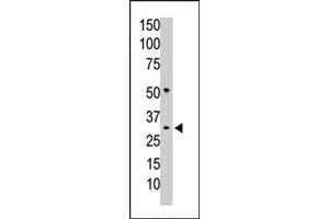 The PPP1CC polyclonal antibody  is used in Western blot to detect PPP1CC in mouse colon tissue lysate.