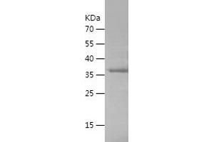 Western Blotting (WB) image for Sema Domain, Immunoglobulin Domain (Ig), Transmembrane Domain (TM) and Short Cytoplasmic Domain, (Semaphorin) 4D (SEMA4D) (AA 759-862) protein (His-IF2DI Tag) (ABIN7283804) (SEMA4D/CD100 Protein (AA 759-862) (His-IF2DI Tag))