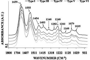 Fourier-transform infrared (FTIR) spectroscopy. (COL6 Protein)
