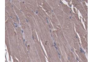 DAB staining on IHC-P; Samples: Mouse Skeletal muscle Tissue (NT5C antibody  (AA 12-200))