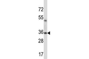 ERCC1 antibody western blot analysis in mouse lung tissue lysate (ERCC1 antibody  (AA 268-297))