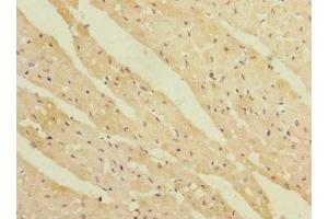 Immunohistochemistry of paraffin-embedded human heart tissue using ABIN7167443 at dilution of 1:100 (REEP3 antibody  (AA 80-255))