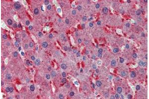 Human Liver: Formalin-Fixed, Paraffin-Embedded (FFPE) (FZD2 antibody  (AA 267-279))