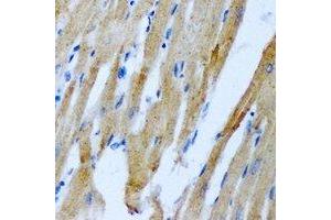 Immunohistochemical analysis of RRM2 staining in rat heart formalin fixed paraffin embedded tissue section. (RRM2 antibody)