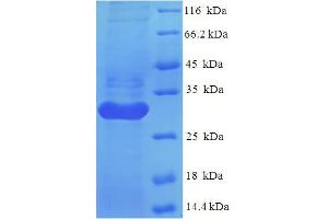 SDS-PAGE (SDS) image for Leukocyte Immunoglobulin-Like Receptor, Subfamily A (With TM Domain), Member 5 (LILRA5) (AA 42-268), (Extracellular) protein (His tag) (ABIN5709863)