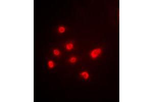 Immunofluorescent analysis of TBP staining in HEK293T cells. (TBP antibody  (Center))