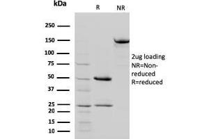 SDS-PAGE Analysis Purified STAT5B Mouse Monoclonal Antibody (STAT5B/2657). (STAT5B antibody)