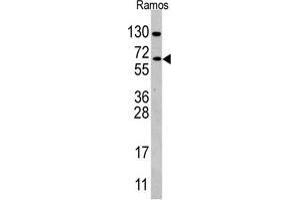 Western blot analysis of anti-CDC25B Antibody (Center) in Ramos cell line lysates (35 µg/lane). (CDC25B antibody  (Center))