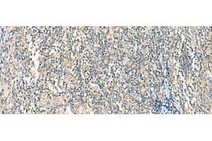 Immunohistochemistry of paraffin-embedded Human tonsil tissue using HASPIN Polyclonal Antibody at dilution of 1:45(x200) (GSG2 antibody)