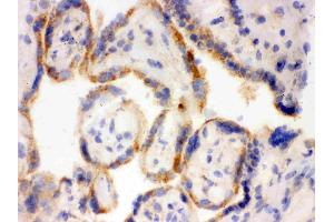 IHC analysis of Surfactant protein D using anti-Surfactant protein D antibody .