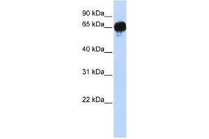 DGKE antibody used at 1 ug/ml to detect target protein. (DGKE antibody  (N-Term))