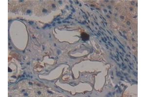 Detection of FMOD in Human Liver Tissue using Polyclonal Antibody to Fibromodulin (FMOD) (Fibromodulin antibody  (AA 19-376))