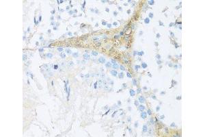 Immunohistochemistry of paraffin-embedded Mouse leydig cells using NRF2 Polyclonal Antibody at dilution of 1:100 (40x lens). (NRF2 antibody)