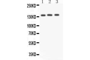 Anti- ACE antibody, Western blottingAll lanes: Anti ACE  at 0. (Angiotensin I Converting Enzyme 1 antibody  (N-Term))