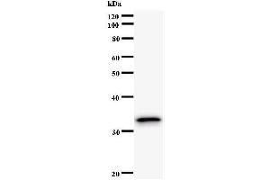 Western Blotting (WB) image for anti-PAP Associated Domain Containing 7 (PAPD7) antibody (ABIN931070) (PAP Associated Domain Containing 7 (PAPD7) antibody)