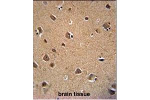 Immunohistochemistry (Paraffin-embedded Sections) (IHC (p)) image for anti-V-Akt Murine Thymoma Viral Oncogene Homolog 3 (Protein Kinase B, Gamma) (AKT3) antibody (ABIN659026)