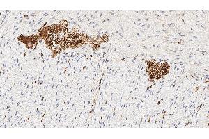 Immunohistochemistry (IHC) image for anti-B-Cell CLL/lymphoma 2 (BCL2) antibody (ABIN7538843)