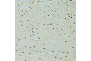 Immunohistochemistry (Paraffin-embedded Sections) (IHC (p)) image for anti-Regulator of Chromosome Condensation 1 (RCC1) (AA 1-240) antibody (ABIN6146817)