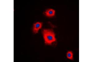 Immunofluorescent analysis of S6K1 (pS447) staining in A549 cells. (RPS6KB1 antibody  (C-Term, pSer447))