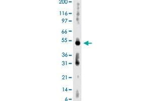 Western blot analysis of human kidney lysate with AKT3 monoclonal antibody, clone 66C1247. (AKT3 antibody  (AA 119-136))