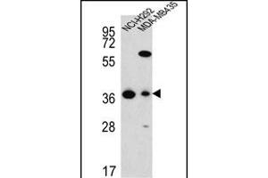 FAHD2A Antibody (C-term) (ABIN652133 and ABIN2840559) western blot analysis in NCI-,MDA-M cell line lysates (35 μg/lane).