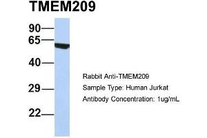Host: Rabbit Target Name: TMEM209 Sample Type: Human Jurkat Antibody Dilution: 1. (TMEM209 antibody  (N-Term))