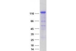 Western Blotting (WB) image for C-Jun-Amino-Terminal Kinase-Interacting Protein 2 (JIP-2) (Transcript Variant 2) protein (Myc-DYKDDDDK Tag) (ABIN2726080)
