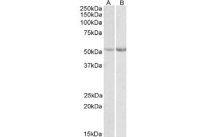 ABIN571236 (0. (Phenylalanine Hydroxylase antibody  (Internal Region))
