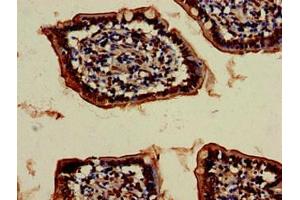 Immunohistochemistry of paraffin-embedded human small intestine tissue using ABIN7175320 at dilution of 1:100 (VPS4B antibody  (AA 1-117))