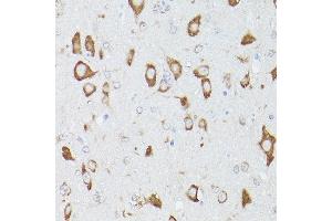 Immunohistochemistry (IHC) image for anti-Ribosomal Protein S18 (RPS18) (AA 1-152) antibody (ABIN6147205)