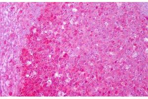 Immunohistochemistry (IHC) image for anti-Heat Shock Protein 90kDa alpha (Cytosolic), Class A Member 1 (HSP90AA1) antibody (ABIN1102186)