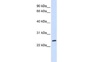 WB Suggested Anti-BAD Antibody Titration: 0. (BAD antibody  (C-Term))
