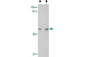 Western blot analysis of LGI4 in human brain tissue lysate with LGI4 polyclonal antibody  at (A) 1 and (B) 2 ug/mL . (LGI4 antibody  (Internal Region))