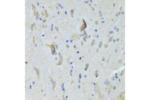 Immunohistochemistry of paraffin-embedded rat spinal cord using SARS Antibody. (Seryl-tRNA Synthetase (SARS) (AA 1-300) antibody)