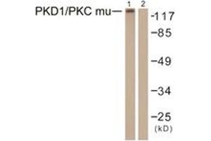 Western blot analysis of extracts from HepG2 cells, using PKD1/PKC mu (Ab-463) Antibody.