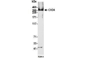 Western Blotting (WB) image for anti-Chromodomain Helicase DNA Binding Protein 4 (CHD4) antibody (ABIN7453323) (Recombinant CHD4 antibody)