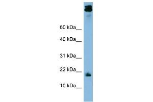 WB Suggested Anti-ASAH1 Antibody Titration: 0. (ASAH1 antibody  (Middle Region))