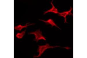 ABIN6274620 staining Hela by IF/ICC. (CMKLR1 antibody  (Internal Region))