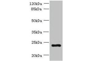 Western blot All lanes: PQLC3 antibody at 3 μg/mL + Mouse liver tissue Secondary Goat polyclonal to rabbit IgG at 1/10000 dilution Predicted band size: 23, 21 kDa Observed band size: 23 kDa (PQLC3 antibody  (AA 118-170))