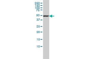 DNAJA2 monoclonal antibody (M01), clone 2A11-F2 Western Blot analysis of DNAJA2 expression in A-431 .