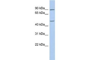 WB Suggested Anti-PLAG1 Antibody Titration:  0. (PLAG1 antibody  (C-Term))