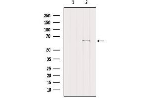 Western blot analysis of extracts from B16F10, using SLC22A6 Antibody. (SLC22A6 antibody  (C-Term))