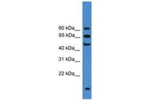 Image no. 1 for anti-Uromodulin (UMOD) (C-Term) antibody (ABIN6745413) (Uromodulin antibody  (C-Term))